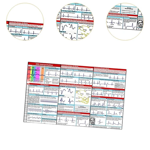 EKG Pocket Guide Präsentation Tools Display Lehrversorgung - Bild 6 von 7