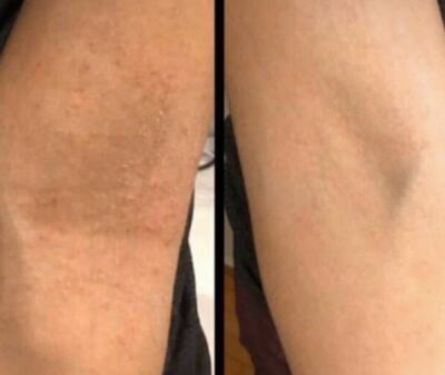 Gemmove Multi-ionizer for Shower -Heals Scalp, Skin, Gum. Gemma