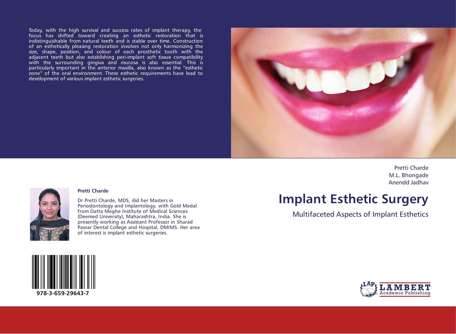 Thumbnail - Pretti Charde (u. A.) | Implant Esthetic Surgery | Taschenbuch |