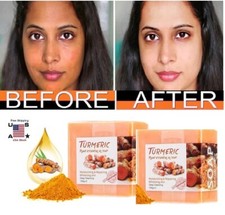 Tumeric Soap Skin Whitening Dark Spots lightening Acne Brightening Turmeric USA