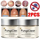 FungiClear Phrena Nail Care Cream With Tea Tree Oil, Oregano Oil, Vitamin E~2026