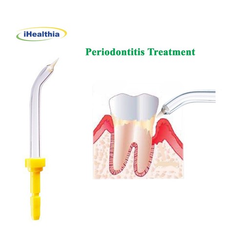 4 Replacement Periodontal/Pocket Tips for Waterpik or other Water Flossers - Picture 4 of 4