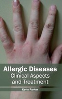 Kevin Parker | Allergic Diseases | Buch | Englisch (2015) | Gebunden