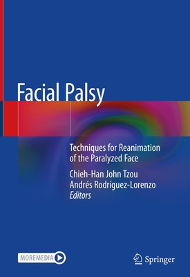 Facial Palsy Andrés Rodríguez-Lorenzo