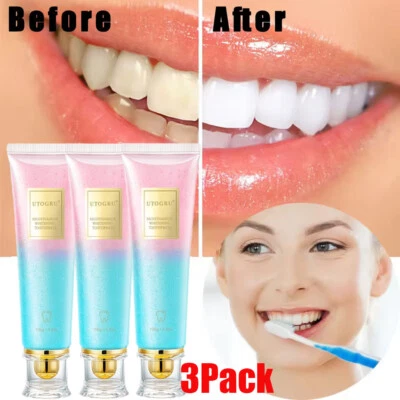 UTOGRU 3Pc Niacinamide Whitening Toothpaste Natural Teeth Intense Stain Oral Fresh 100g