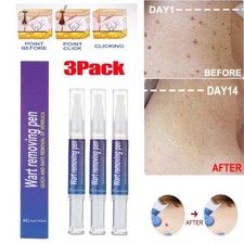 3-Pack Skin Tag Remover Warts Remover Pen Eliminate Mole Foot Corn for Men Women