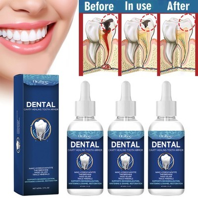 3PCS Gum Protect Repair Solution Reduce Inflammatic Dentizen Gum Teeth Whitening