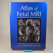  Atlas of Fetal Mri by Deborah Levine Hardcov...