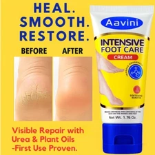 Aavini Foot Cream 50g – Repair Dry Cracked Heels, Deep Moisture & Odor Defense
