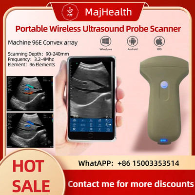 Portable 96E Wireless Ultrasound Scanner Machine - Handheld Diagnostic Imaging