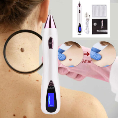 Skin Dark Spot Removal Device Skin Care for Face/Body,Remove Spot/Warts Painless