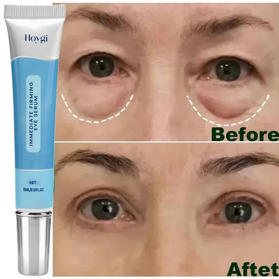 #ad Eye Cream Instant Remove Eye Bags Dark Circles Anti Wrinkle Depuffing Firming US $10.45