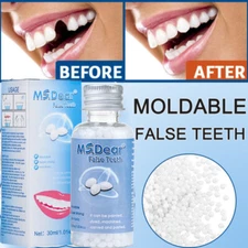 False Teeth Solid Glue Temporary Tooth Repair Moldable Fix Broke Gap Teeth Beads