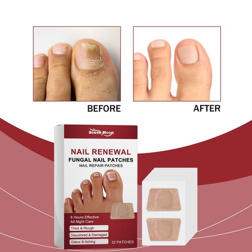 NAIL RENEWAL FUNGAL PATCHES NAIL REPAIR Thick&Rough Discolored&Damaged 32Pcs - Picture 2 of 16