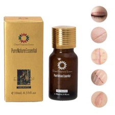 Dredge Meridian Skin Care Natural Pure Removal Acne Stretch Marks Scar Removal E