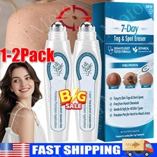 Tag Spot Eraser Mole Skin Tags Removal Tool Eraser Pen Painless Long-Lasting US