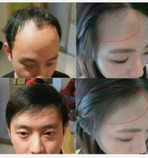 Weilaiya Ginger Hair Shampoo 400ml and Conditioner 250ml Set (USA Seller)