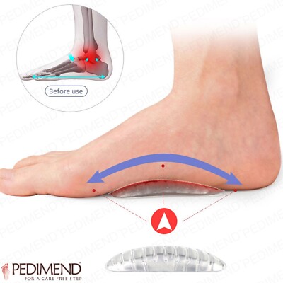 Pedimend  Gestreifte Gel Fußgewölbe Einlegesohle für Plattfuß (1 PAAR) - Fußpflege - UK