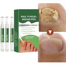 Antifungal Pen Toenail Fungus Treatment Extra
