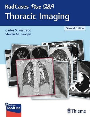 RadCases Plus Q&a Thoracic Imaging by Carlos S. Restrepo, Ste... - 9781626238145