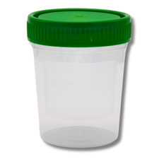 Urinbecher mit Schraubdeckel 100 ml I Probenbecher Urinbehälter Urinprobenbecher
