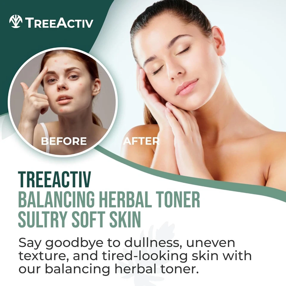 TreeActiv Herbal Toner 4 fl oz, Balance & Even Skin Tone, Rose Water Moisturizer - Image 2 of 4