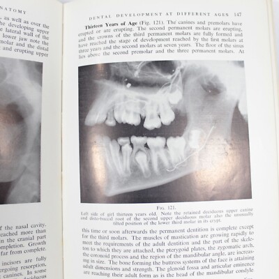 Vintage Zahnmedizin Buch Einführung in die zahnärztliche Anatomie James Henderson Scott 