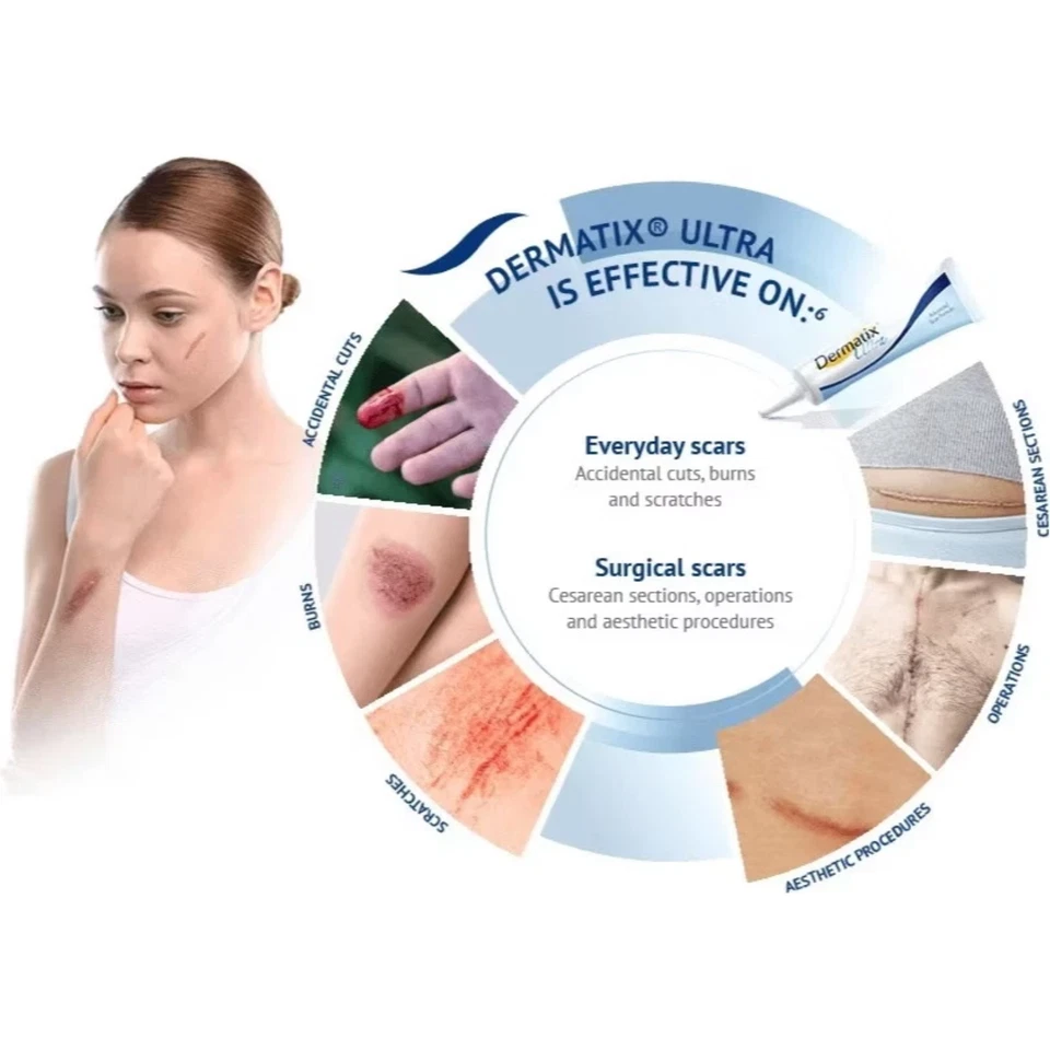 Scar Gel Dermatix Ultra Advanced 15g Silicone Treatment Lot of 10 Tubes - 2027 - Image 4 of 4