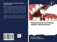 Vishal Tapadiq (U. A.) | Nemedlennaq Ustanowka Zubnyh Implantatow | Taschenbuch