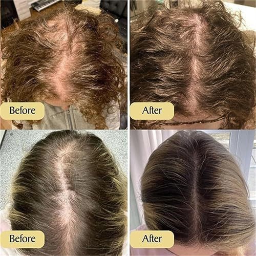 Natürliches Haarwachstumsöl Veganes organisches natürliches Haarwachstumsöl 60ML - Photo 4/19