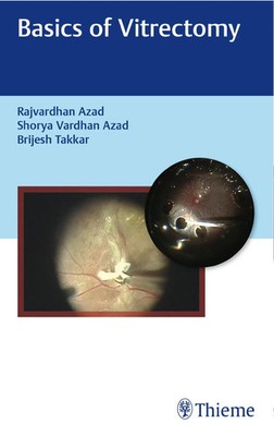 Basics of Vitrectomy | Rajvardhan Azad | Englisch | Buch | 216 S. | 2019