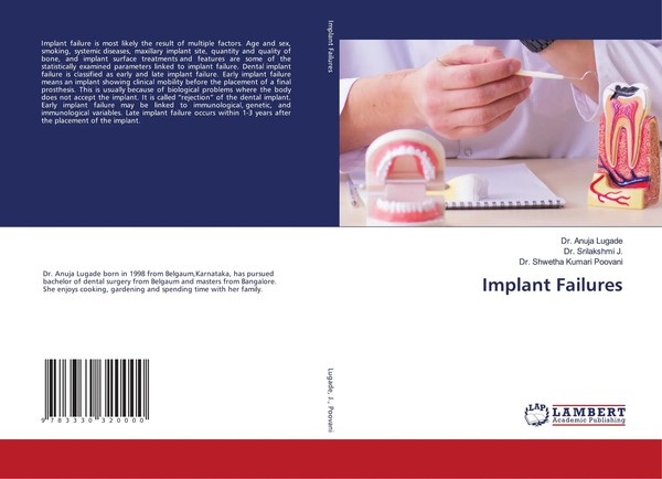 Anuja Lugade (U. A.) | Implant Failures | Taschenbuch | Englisch (2024)-image