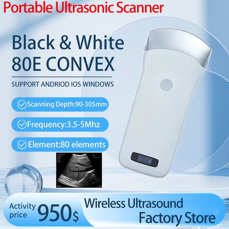 Wireless ultrasound convex probe 3. 5/5 mhz 80 element scanner portable machine