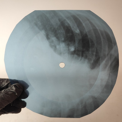 DAVID BOWIE WHEN I'M FIVE X-Ray USSR Record Roentgen Bone Ribs Music Vinyl