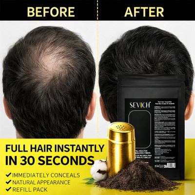      SEVICH Hair Fibers for Men   Hair Loss Concealer for Thin Hair