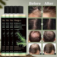 4X Rosemary Hydrolyzed Keratin Shampoo Nourishing,Rosemary Hair Regrowth Shampoo