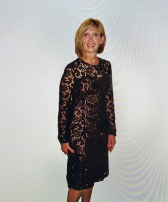 prada guipure lace dress Prada Guipure Lace Mini Dress - Black