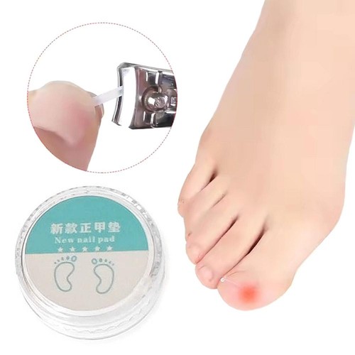 Corrector de uñas almohadilla de uñas encarnada ranura herramienta para el cuidado de los pies corrector de uñas de los pies 50 un. - Imagen 2 de 16