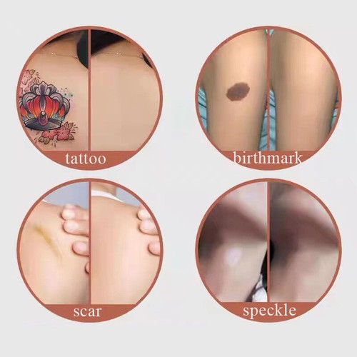 6pcs Flaw Hide Tape Birthmark Scar Acne Tattoo Cover Up Concealing Hide Sticke 、 - Picture 8 of 16