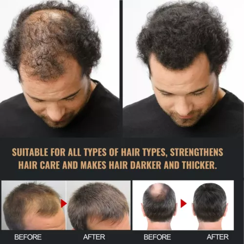 Shampoo attivatore radici, SPARTAN shampoo perdita capelli, shampoo attivatore radici - Foto 4 di 12