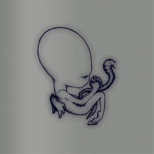 sigur ros アルバム　DVDセット 20th Anniversary Edition | Sigur Rós