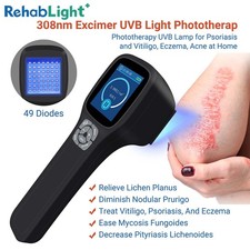 Rechargeable 308nm Handheld Phototherapy Device with Sapphire Lens for Skin Care
