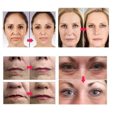 3 in 1 Skincare Micro Needle Roller Pins 0.5mm/1.0mm/1.5mm Reduction of wrinkles