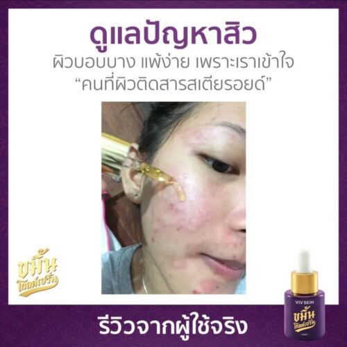 Turmeric Gold Serum Reduce Acne Dark Spot Wrinkles face 14 ml - Picture 16 of 23