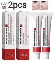 Powerful Spot-removing Whiten Cream Pigmentation Melasma Dark Spots