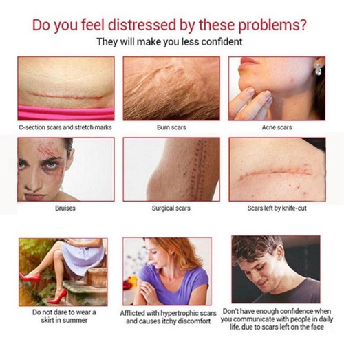 Dermatix Ultra-Advanced Scar Gel Reduction - Silicone GelDermatix Ultra DE - Bild 5 von 9