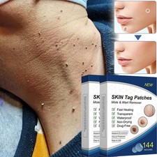 Skin Tag Remover Patches Quick Effective Mole and Wart Pad Removal Sticker US