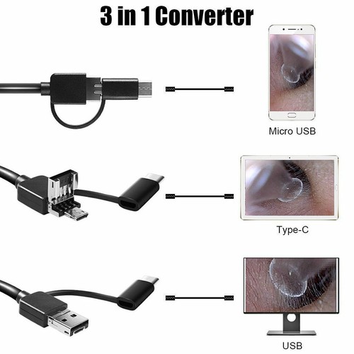 3 in 1 HD Ohr Reinigung USB Endoskop Ohrstocher mit Kamera HD Ohrenschmalz Entfernung Kit - Bild 8 von 12