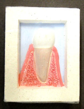 vintage #10 McKesson Robbins DISPLAY TOOTH Dentist study aid dental dentistry z5