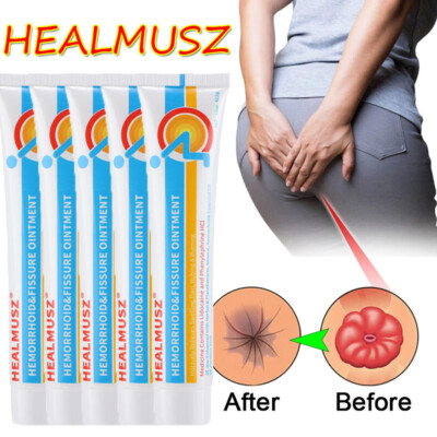 Hemorrhoid Treatment Cream Haemorrhoids Piles Anal Fissure Prolapse Cream Gel